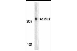 Image no. 2 for anti-Apoptotic Chromatin Condensation Inducer 1 (ACIN1) (Cytoplasmic Domain) antibody (ABIN189910)