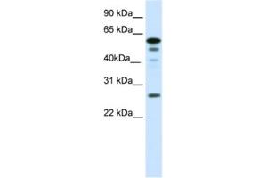 Image no. 1 for anti-Forkhead Box D1 (FOXD1) antibody (ABIN2461434)