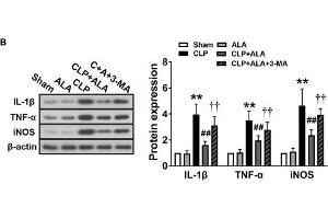 Image no. 7 for anti-Interleukin 1, beta (IL1B) (AA 101-200) antibody (ABIN728503)