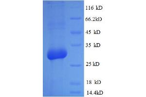 Image no. 1 for Osteocalcin (BGLAP) (AA 50-99) protein (GST tag) (ABIN5709135)