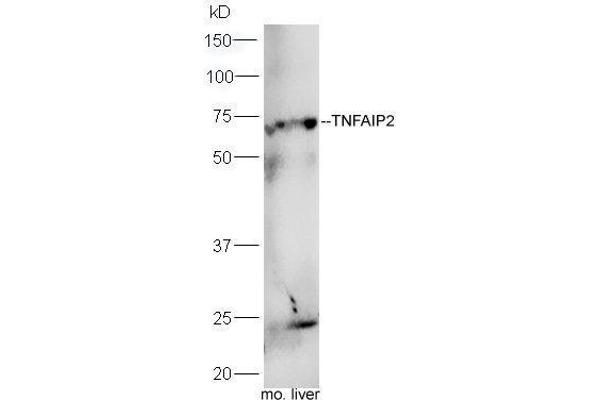 anti-Tumor Necrosis Factor, alpha-Induced Protein 2 (TNFAIP2) (AA 551-654) antibody