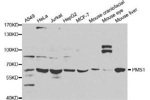 PMS1 antibody  (AA 405-619)