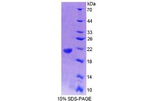 Image no. 1 for Glucosidase, Alpha, Acid (GAA) (AA 70-225) protein (His tag) (ABIN6238655)