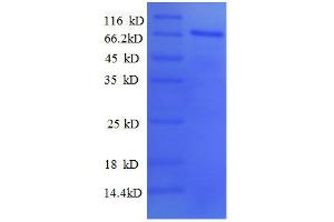 Image no. 1 for Paired Box Gene 2a (PAX2A) (AA 1-363), (partial) protein (GST tag) (ABIN1047492)