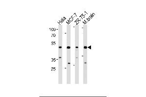 Image no. 1 for anti-F-Box Protein 28 (FBXO28) (AA 339-368), (C-Term) antibody (ABIN1881338)