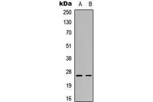Image no. 1 for anti-Complement Component 1, Q Subcomponent, C Chain (C1QC) (Center) antibody (ABIN2972925)