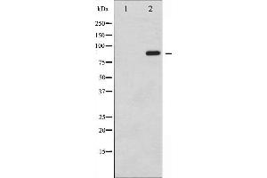 Image no. 3 for anti-Signal Transducer and Activator of Transcription 6, Interleukin-4 Induced (STAT6) (pTyr641) antibody (ABIN6256781)