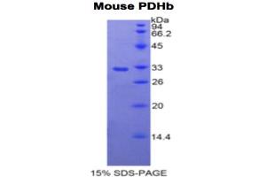 Image no. 1 for Pyruvate Dehydrogenase beta (PDHB) protein (ABIN3011406)