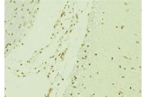 Image no. 1 for anti-Mitogen-Activated Protein Kinase 9 (MAPK9) (C-Term) antibody (ABIN6254890)