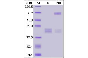 Image no. 2 for CD8 (CD8) (AA 22-182) (Active) protein (His tag,FITC) (ABIN6973025)