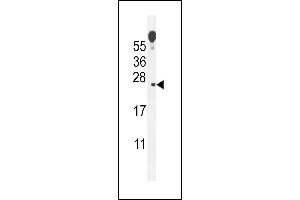 VOPP1 抗体  (AA 65-95)
