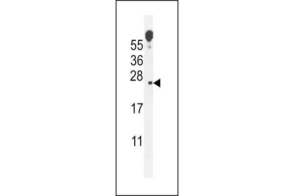VOPP1 抗体  (AA 65-95)