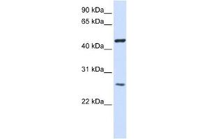 Image no. 1 for anti-Transmembrane Protein 127 (TMEM127) (Middle Region) antibody (ABIN635454)