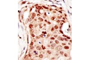 Image no. 2 for anti-Cbl proto-oncogene C (CBLC) (C-Term) antibody (ABIN356779)