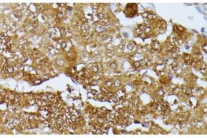 Immunohistochemistry of paraffin-embedded Rat liver using SEPT4 Polyclonal Antibody at dilution of 1:100 (40x lens).