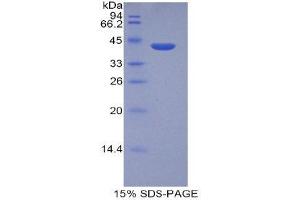 Image no. 1 for Histone Cluster 2, H2aa3 (HIST2H2AA3) (AA 1-130) protein (His tag,GST tag) (ABIN1821788)