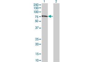 anti-Zinc Finger Protein 18 (ZNF18) (AA 282-380) antibody