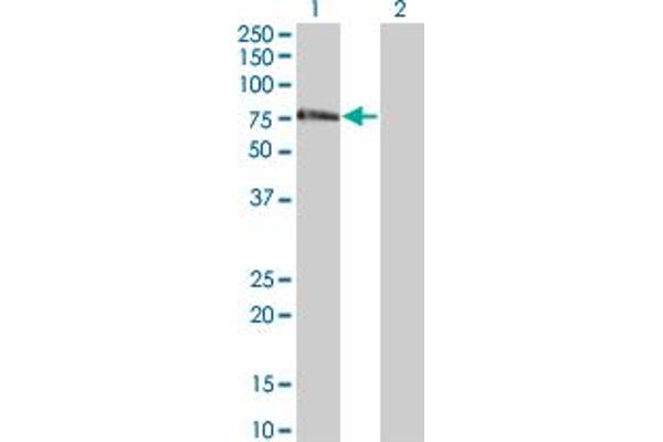 anti-Zinc Finger Protein 18 (ZNF18) (AA 282-380) antibody