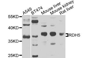 Image no. 1 for anti-Retinol Dehydrogenase 5 (11-Cis/9-Cis) (RDH5) antibody (ABIN2737457)