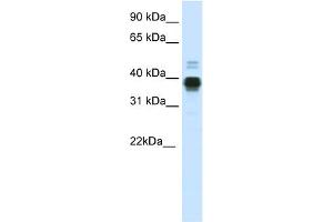 Image no. 2 for anti-Homeobox A11 (HOXA11) (C-Term) antibody (ABIN2779940)