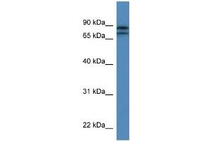 Image no. 1 for anti-Kelch-Like 22 (KLHL22) (N-Term) antibody (ABIN2774291)