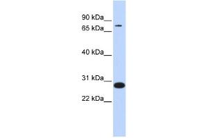 Image no. 1 for anti-Transcription Factor 12 (TCF12) (Middle Region) antibody (ABIN2792577)