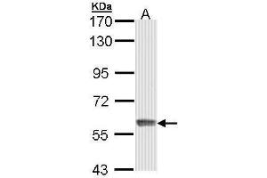Image no. 3 for anti-Interferon-Induced Protein with Tetratricopeptide Repeats 3 (IFIT3) (Center) antibody (ABIN2856864)