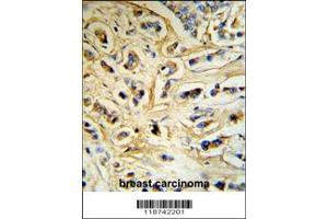 Immunohistochemistry (IHC) image for anti-Casein alpha S1 (CSN1S1) antibody (ABIN2158385)