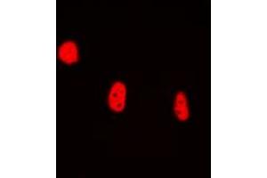Image no. 1 for anti-High Mobility Group 20B (HMG20B) (N-Term) antibody (ABIN2707371)