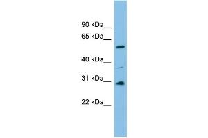 Image no. 1 for anti-Dihydrouridine Synthase 1-Like (DUS1L) (Middle Region) antibody (ABIN2787301)