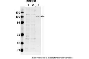 Image no. 1 for anti-Retinoblastoma Binding Protein 8 (RBBP8) (C-Term) antibody (ABIN2784374)