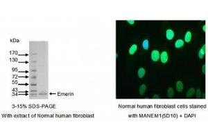 Image no. 1 for anti-Emerin (EMD) (AA 1-188) antibody (ABIN1042591)