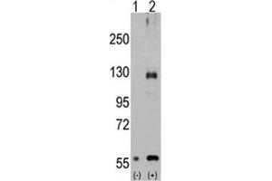 Image no. 3 for anti-Transient Receptor Potential Cation Channel, Subfamily M, Member 8 (TRPM8) (AA 521-552) antibody (ABIN3029240)