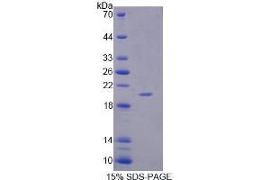 Image no. 1 for Interleukin 1 Family Member 9 (IL1F9) (AA 5-153) protein (His tag) (ABIN6239145)