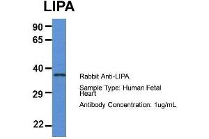 Image no. 2 for anti-Lipase A, Lysosomal Acid, Cholesterol Esterase (LIPA) (N-Term) antibody (ABIN2788678)