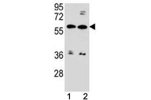 Image no. 2 for anti-ATP-Binding Cassette, Sub-Family G (WHITE), Member 4 (ABCG4) (AA 36-65) antibody (ABIN3030063)