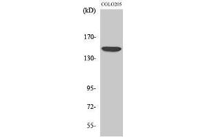 Image no. 1 for anti-ATP-Binding Cassette, Sub-Family C (CFTR/MRP), Member 10 (ABCC10) (Internal Region) antibody (ABIN3185639)