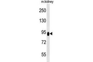 ZBTB41 antibody  (Middle Region)