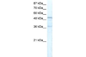 Image no. 1 for anti-Forkhead Box C1 (FOXC1) (C-Term) antibody (ABIN2779552)