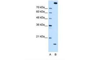 Image no. 1 for anti-Melanoma Inhibitory Activity Protein 2 (MIA2) (AA 413-462) antibody (ABIN6738411)