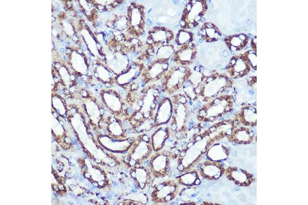 Hexokinase 1 anticorps