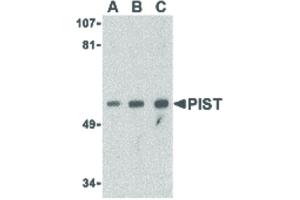 Image no. 1 for anti-Golgi-Associated PDZ and Coiled-Coil Motif Containing (GOPC) (Internal Region) antibody (ABIN6655940)