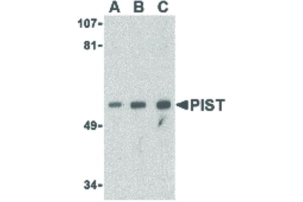 anti-Golgi-Associated PDZ and Coiled-Coil Motif Containing (GOPC) (Internal Region) antibody