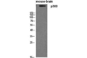 Anti-Brain lipid binding protein Antibody from rabbit, purified by affinity  chromatography