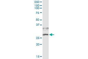 Image no. 3 for anti-CD79b Molecule, Immunoglobulin-Associated beta (CD79B) (AA 1-229) antibody (ABIN560258)