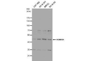 Image no. 5 for anti-Homer Homolog 1 (HOMER1) (Center) antibody (ABIN2855600)