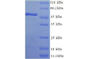 Image no. 1 for Transcription Elongation Factor A2 (TCEA2) (AA 1-299), (full length) protein (His-SUMO Tag) (ABIN5711299)