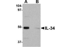 Image no. 1 for anti-Interleukin 34 (IL34) (Center) antibody (ABIN500018)