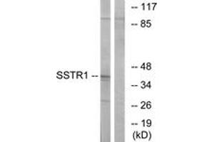 Image no. 1 for anti-Somatostatin Receptor 1 (SSTR1) (AA 9-58) antibody (ABIN1535996)