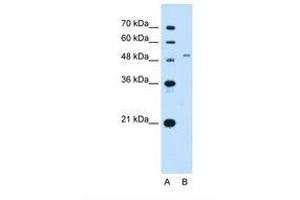 Image no. 2 for anti-Solute Carrier Family 29 (Nucleoside Transporters), Member 2 (SLC29A2) (AA 51-100) antibody (ABIN320827)